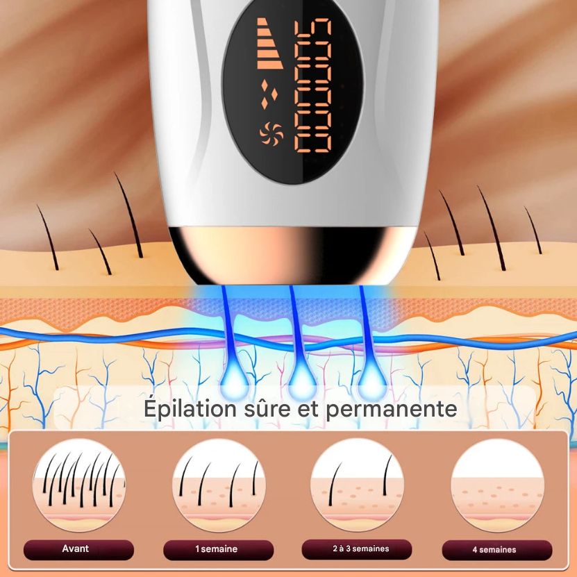 Epilateur Laser Portable IPL